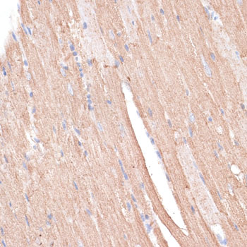 Immunohistochemistry of paraffin-embedded Mouse heart using KCNK1 Polyclonal Antibody at dilution of  1:100 (40x lens).