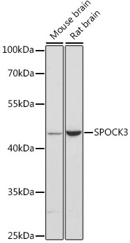 Western blot analysis of extracts of various cell lines using SPOCK3 Polyclonal Antibody at dilution of 1:3000.