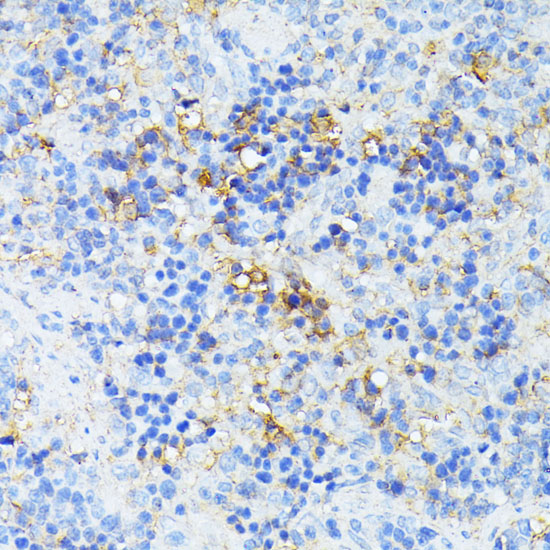 Immunohistochemistry of paraffin-embedded Rat spleen using TP53I11 Polyclonal Antibody at dilution of  1:100 (40x lens).