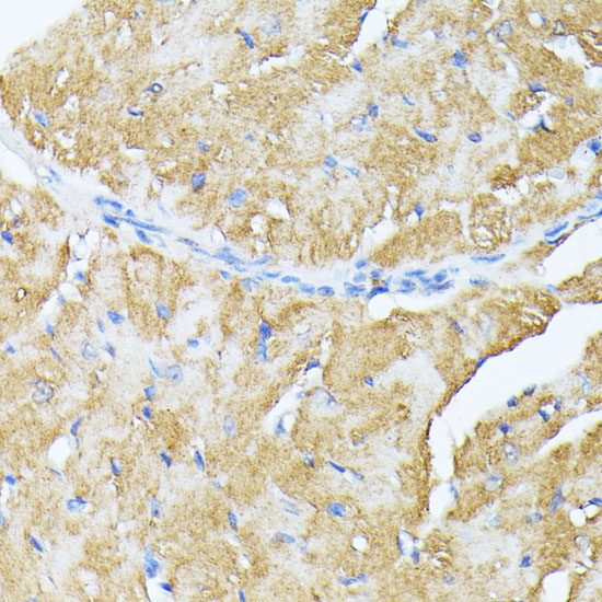 Immunohistochemistry of paraffin-embedded Mouse heart using TP53I11 Polyclonal Antibody at dilution of  1:100 (40x lens).