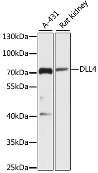 Western blot analysis of extracts of various cell lines using DLL4 Polyclonal Antibody at dilution of 1:3000.