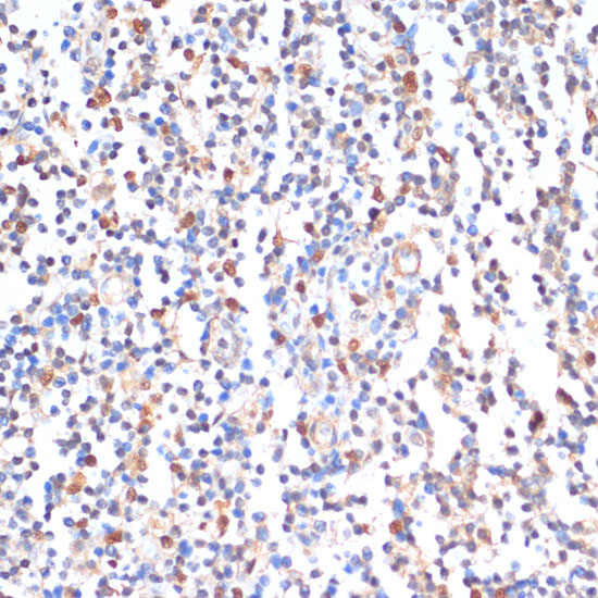 Immunohistochemistry of paraffin-embedded Human tonsil using ZMYM3 Polyclonal Antibody at dilution of  1:100 (40x lens).