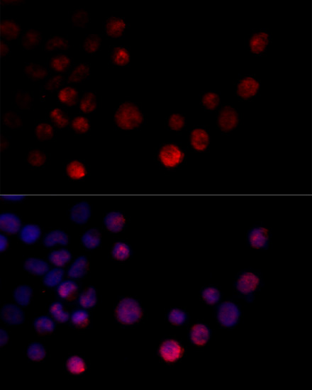 Immunofluorescence analysis of 293T cells using HNRNPH2 Polyclonal Antibody at dilution of  1:100 (40x lens). Blue: DAPI for nuclear staining.