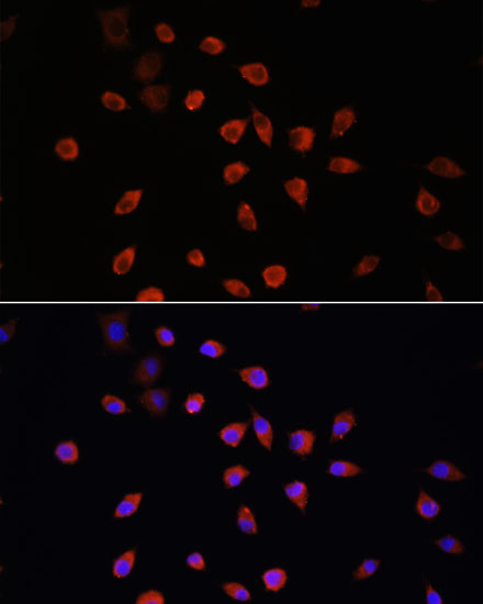 Immunofluorescence analysis of L929 cells using IFT88 Polyclonal Antibody at dilution of  1:100. Blue: DAPI for nuclear staining.