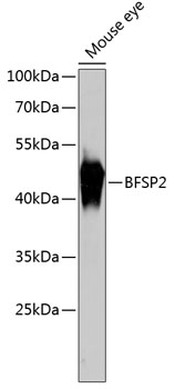 Western blot analysis of extracts of Mouse eye using BFSP2 Polyclonal Antibody at dilution of 1:3000.