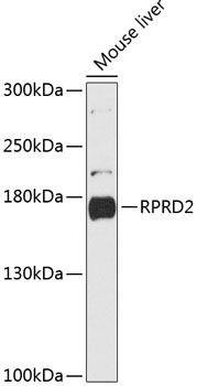 Western blot analysis of extracts of Mouse liver using RPRD2 Polyclonal Antibody at dilution of 1:3000.