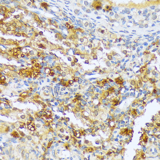 Immunohistochemistry of paraffin-embedded Rat ovary using A1CF Polyclonal Antibody at dilution of  1:100 (40x lens).