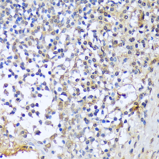 Immunohistochemistry of paraffin-embedded Human tonsil using A1CF Polyclonal Antibody at dilution of  1:100 (40x lens).