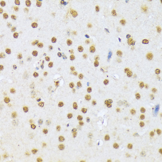 Immunohistochemistry of paraffin-embedded Mouse brain using A1CF Polyclonal Antibody at dilution of  1:100 (40x lens).