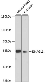 Western blot analysis of extracts of various cell lines using TINAGL1 Polyclonal Antibody at dilution of 1:3000.