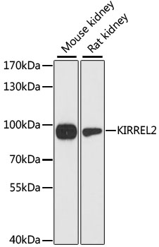 Western blot analysis of extracts of various cell lines using KIRREL2 Polyclonal Antibody at dilution of 1:3000.