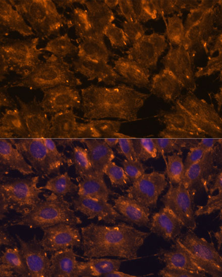 Immunofluorescence analysis of C6 cells using SCGB3A2 Polyclonal Antibody at dilution of  1:100. Blue: DAPI for nuclear staining.