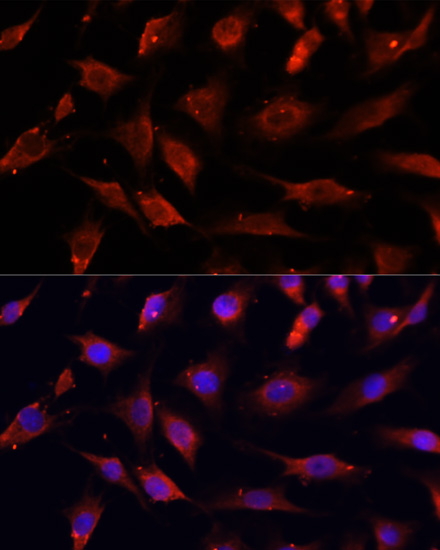 Immunofluorescence analysis of C6 cells using DNASE1L1 Polyclonal Antibody at dilution of  1:100. Blue: DAPI for nuclear staining.