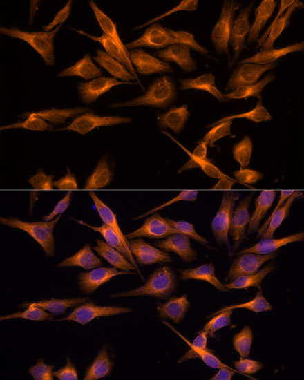 Immunofluorescence analysis of HeLa cells using UNG Polyclonal Antibody at dilution of  1:100. Blue: DAPI for nuclear staining.