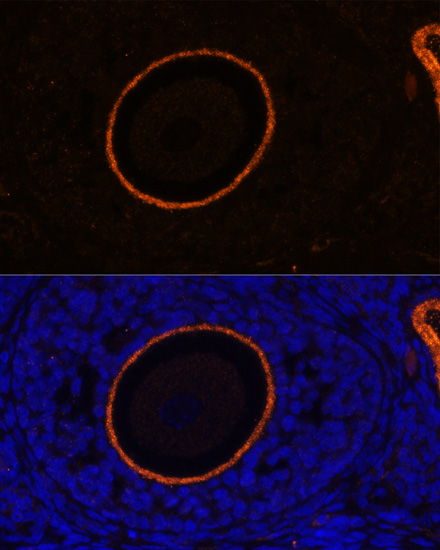 Immunofluorescence analysis of Rat oophoroma cells using ZP3 Polyclonal Antibody at dilution of  1:100. Blue: DAPI for nuclear staining.