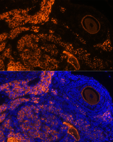 Immunofluorescence analysis of Rat oophoroma cells using ZP3 Polyclonal Antibody at dilution of  1:100. Blue: DAPI for nuclear staining.