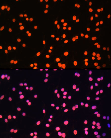 Immunofluorescence analysis of C6 cells using ZNF581 Polyclonal Antibody at dilution of  1:100 (40x lens). Blue: DAPI for nuclear staining.