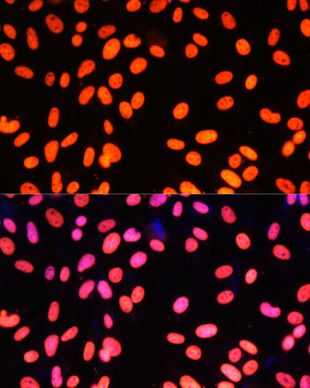 Immunofluorescence analysis of NIH-3T3 cells using ZNF581 Polyclonal Antibody at dilution of  1:100 (40x lens). Blue: DAPI for nuclear staining.