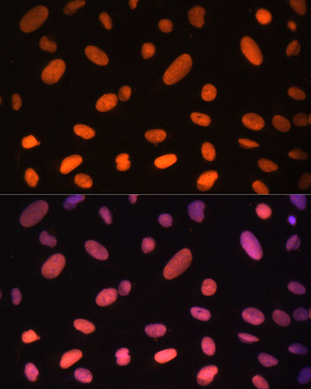 Immunofluorescence analysis of U-2 OS cells using ZNF581 Polyclonal Antibody at dilution of  1:100 (40x lens). Blue: DAPI for nuclear staining.