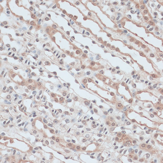 Immunohistochemistry of paraffin-embedded Mouse kidney using ZNF581 Polyclonal Antibody at dilution of  1:100 (40x lens).