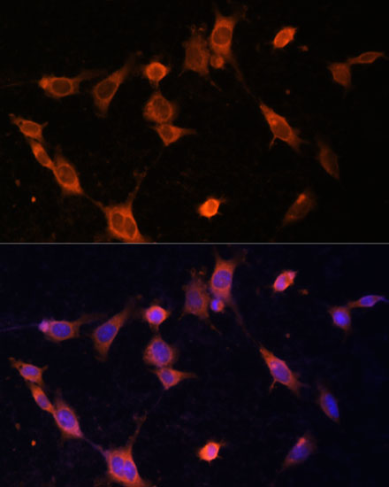 Immunofluorescence analysis of NIH-3T3 cells using UFC1 Polyclonal Antibody at dilution of  1:100 (40x lens). Blue: DAPI for nuclear staining.