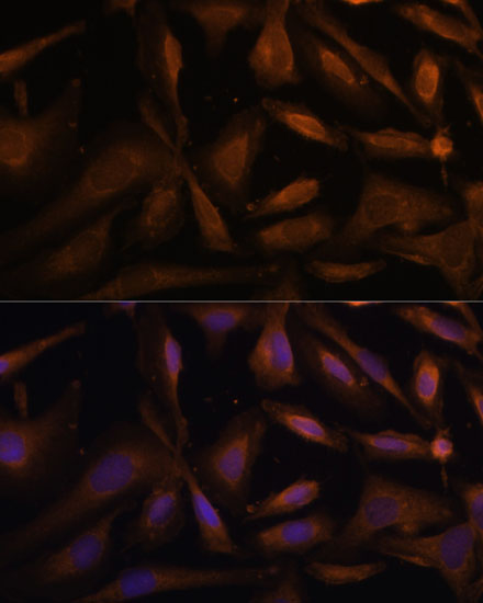 Immunofluorescence analysis of U-2 OS cells using UFC1 Polyclonal Antibody at dilution of  1:100 (40x lens). Blue: DAPI for nuclear staining.