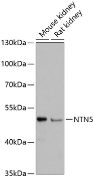 Western blot analysis of extracts of various cell lines using NTN5 Polyclonal Antibody at dilution of 1:3000.