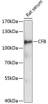 Western blot analysis of extracts of Rat serum using CFB Polyclonal Antibody at dilution of 1:3000.