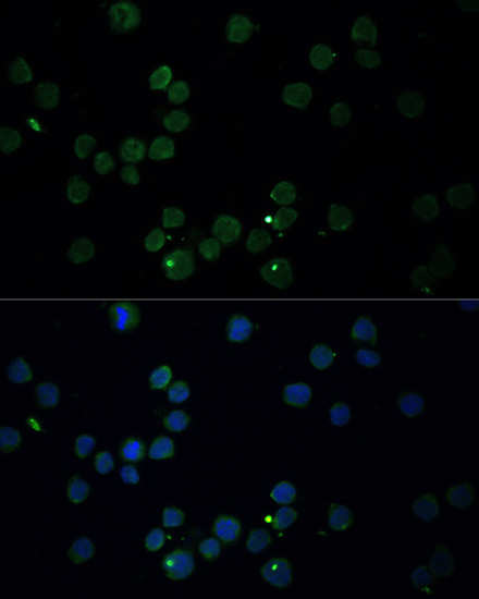 Immunofluorescence analysis of THP-1 cells using CHAT Polyclonal Antibody at dilution of  1:100. Blue: DAPI for nuclear staining.