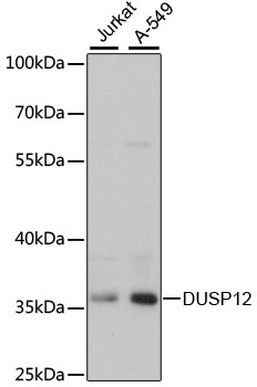 Western blot analysis of extracts of various cell lines using DUSP12 Polyclonal Antibody at dilution of 1:3000.