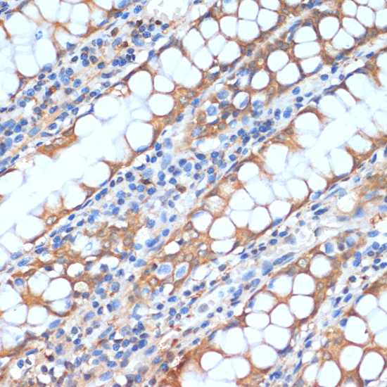 Immunohistochemistry of paraffin-embedded Human colon using HHLA2 Polyclonal Antibody at dilution of  1:100 (40x lens).