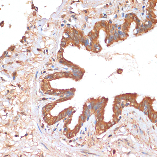 Immunohistochemistry of paraffin-embedded Human lung using HHLA2 Polyclonal Antibody at dilution of  1:100 (40x lens).