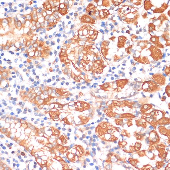 Immunohistochemistry of paraffin-embedded Human stomach using HHLA2 Polyclonal Antibody at dilution of  1:100 (40x lens).