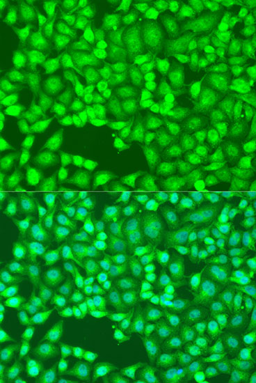 Immunofluorescence analysis of U2OS cells using FLT4 Polyclonal Antibody at dilution of  1:100. Blue: DAPI for nuclear staining.