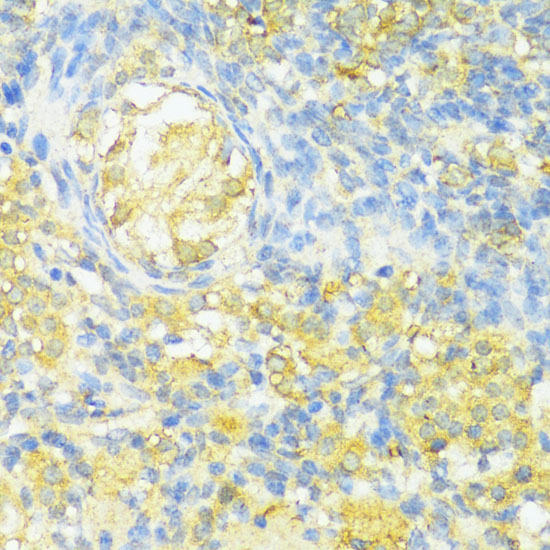 Immunohistochemistry of paraffin-embedded Rat ovary using HLA-DPB1 Polyclonal Antibody at dilution of  1:100 (40x lens).