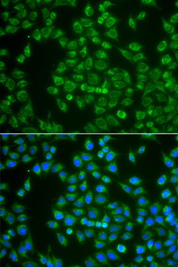Immunofluorescence analysis of A549 cells using MAP4K3 Polyclonal Antibody
