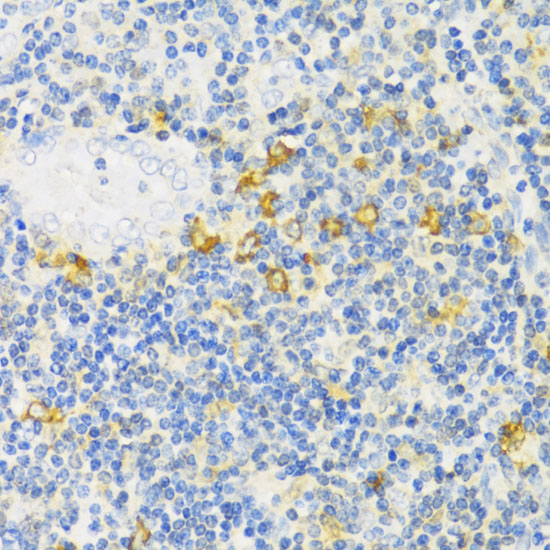 Immunohistochemistry of paraffin-embedded Human tonsil using MLKL Polyclonal Antibody at dilution of  1:100 (40x lens).