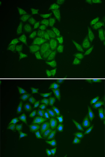 Immunofluorescence analysis of HeLa cells using AMPD3 Polyclonal Antibody