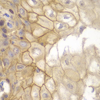 Immunohistochemistry of paraffin-embedded Human esophagus using IL7R Polyclonal Antibody at dilution of  1:100 (40x lens).