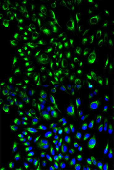 Immunofluorescence analysis of HeLa cells using LCP2 Polyclonal Antibody
