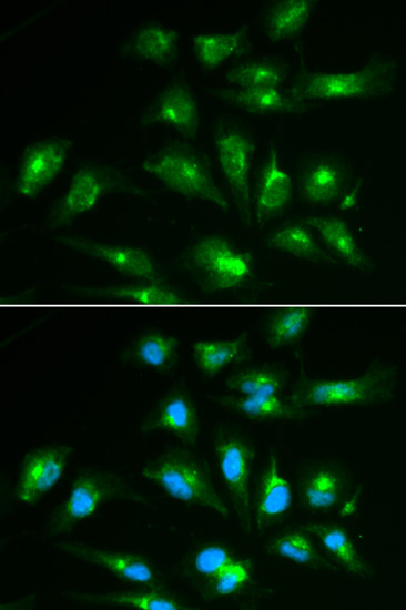 Immunofluorescence analysis of HepG2 cells using CD46 Polyclonal Antibody