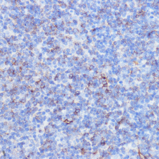 Immunohistochemistry of paraffin-embedded Mouse spleen using NOTCH3 Polyclonal Antibody at dilution of  1:100 (40x lens).