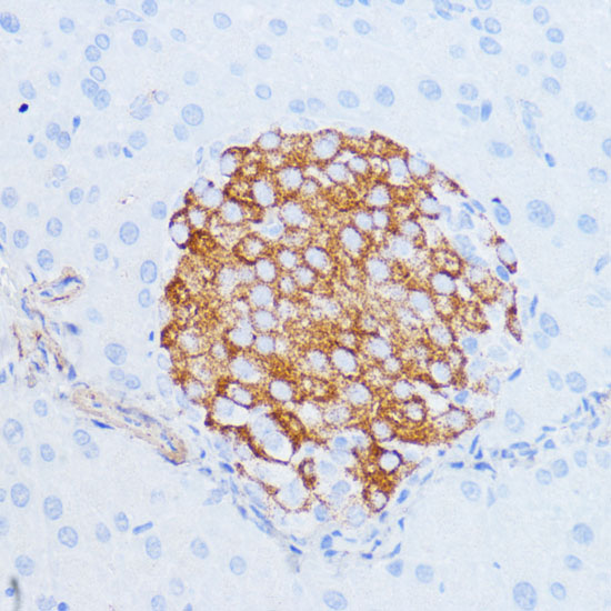 Immunohistochemistry of paraffin-embedded Mouse pancreas using NOTCH3 Polyclonal Antibody at dilution of  1:100 (40x lens).
