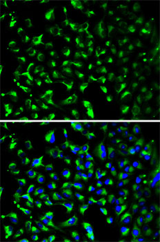 Immunofluorescence analysis of HeLa cells using PHB Polyclonal Antibody