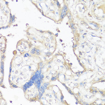 Immunohistochemistry of paraffin-embedded Human placenta using VTN Polyclonal Antibody at dilution of  1:100 (40x lens).