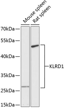 Western blot analysis of extracts of various cell lines using KLRD1 Polyclonal Antibody at dilution of 1:3000.
