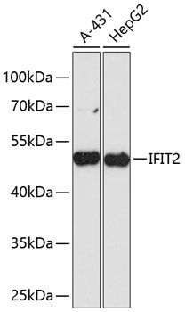 Western blot analysis of extracts of various cell lines using IFIT2 Polyclonal Antibody at dilution of 1:3000.