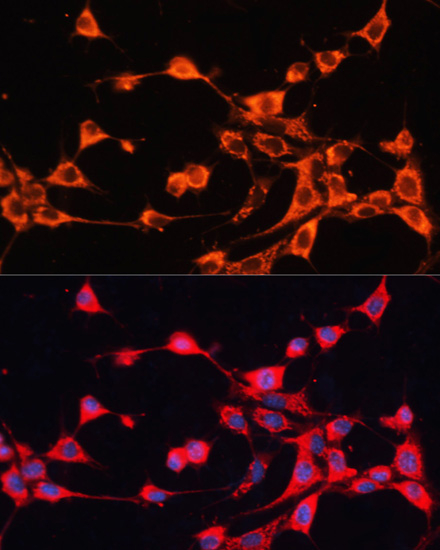 Immunofluorescence analysis of NIH/3T3 cells using ABCB10 Polyclonal Antibody at dilution of  1:100. Blue: DAPI for nuclear staining.