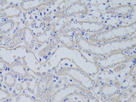 Immunohistochemistry of paraffin-embedded Mouse kidney using AQP5 Polyclonal Antibody at dilution of  1:50 (40x lens).