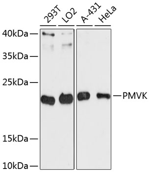 Western blot analysis of extracts of various cell lines using PMVK Polyclonal Antibody at dilution of 1:3000.